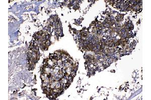 IHC analysis of MMP16 using anti-MMP16 antibody . (MMP16 Antikörper  (AA 120-296))