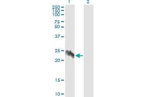 Western Blot analysis of EIF5A2 expression in transfected 293T cell line by EIF5A2 monoclonal antibody (M01), clone 1E7. (EIF5A2 Antikörper  (AA 66-153))