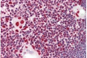 Anti-HnRNP K antibody IHC staining of human thymus. (HNRNPK Antikörper  (AA 200-250))