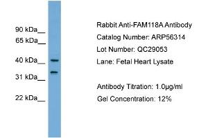 WB Suggested Anti-FAM118A  Antibody Titration: 0. (FAM118A Antikörper  (Middle Region))