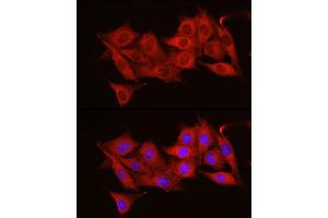 Immunofluorescence analysis of NIH/3T3 cells using  Rabbit pAb (ABIN6131155, ABIN6136539, ABIN6136540 and ABIN6221035) at dilution of 1:50 (40x lens). (ADAM9 Antikörper  (AA 475-685))