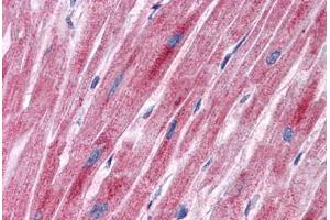 Human Heart: Formalin-Fixed, Paraffin-Embedded (FFPE) (PDK2 Antikörper  (AA 251-300))