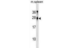 Western Blotting (WB) image for anti-Tumor Suppressor Candidate 1 (TUSC1) antibody (ABIN3000856) (TUSC1 Antikörper)
