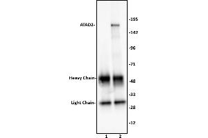 ATAD2 antibody (pAb) tested by Immunoprecipitation. (ATAD2 Antikörper  (C-Term))