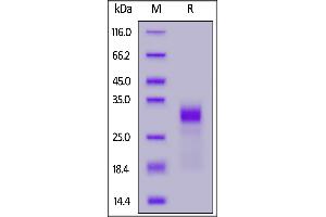SDS-PAGE (SDS) image for Interleukin 33 (IL33) (AA 109-270) (Active) protein (His tag,AVI tag,Biotin) (ABIN6973124)