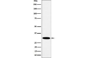 Western blot analysis of HMGCL expression in A431 cell lysate.