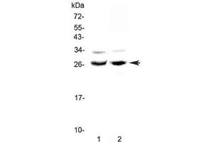 Western blot testing of 1) rat testis and 2) mouse ovary lysate with MAD antibody at 0. (MXD1 Antikörper)