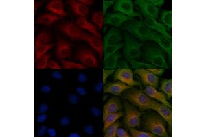 ABIN6257544 and ABIN6275649 staining Hela cells by IF/ICC.