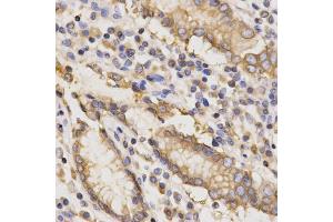 Immunohistochemistry of paraffin-embedded human stomach using TAPBP Antibody. (TAPBP Antikörper)