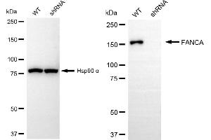 Western blotting analysis using FANCA antibody (ABIN7798563). (Rekombinanter FANCA Antikörper)