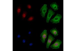 Phospho-RUNX2 (Ser319) Antibody staining A549 cells(4h of LPS treatment) by IF/ICC. (RUNX2 Antikörper  (pSer319))