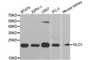 Western blot analysis of extracts of various cell lines, using GLO1 antibody. (GLO1 Antikörper  (AA 1-184))