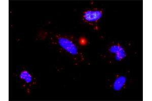 Proximity Ligation Analysis of protein-protein interactions between TGFB1 and MMP9. (MMP 9 Antikörper  (AA 1-707))