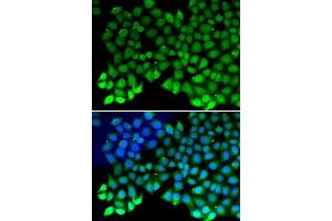 Immunofluorescence analysis of MCF7 cell using RPA1 antibody. (RPA1 Antikörper  (AA 367-616))