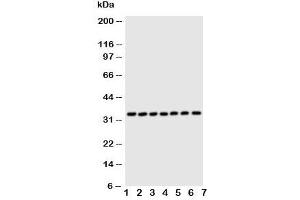 Western blot testing of DCI antibody and Lane 1:  rat liver;  2: human placenta;  3: A549;  4: SMMC-7721;  5: COLO320;  6: HeLa;  7: HT1080 cell lysate