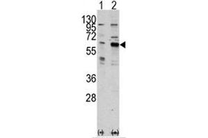 Western blot analysis of PAK3 antibody and 293 cell lysate either nontransfected (Lane 1) or transiently transfected with the PAK3 gene (2). (PAK3 Antikörper  (AA 218-247))