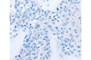 Immunohistochemistry (IHC) image for anti-Neurotrophin 3 (NTF3) antibody (ABIN1873967) (Neurotrophin 3 Antikörper)