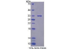 SDS-PAGE analysis of Mouse XYLT1 Protein. (XYLT1 Protein)