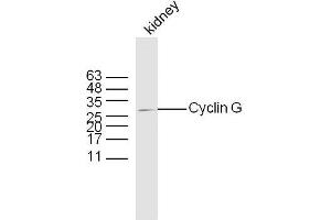 Mouse kidney lysates probed with Rabbit Anti-Cyclin G Polyclonal Antibody, Unconjugated  at 1:300 overnight at 4˚C. (Cyclin G1 Antikörper  (AA 181-295))