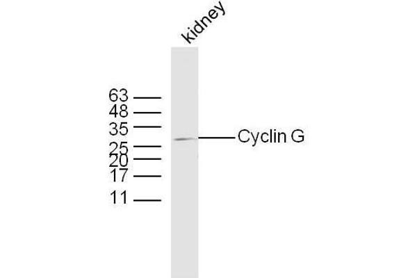 Cyclin G1 Antikörper  (AA 181-295)