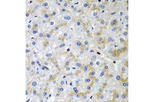 Immunohistochemistry of paraffin-embedded human liver damage using SRGN antibody (ABIN6132571, ABIN6148441, ABIN6148443 and ABIN6222700) at dilution of 1:200 (40x lens). (SRGN Antikörper  (AA 28-158))