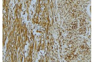 ABIN6268668 at 1/100 staining Mouse muscle tissue by IHC-P. (Vinculin Antikörper  (N-Term))