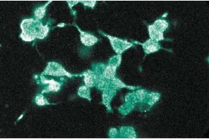 Immunofluorescence staining of PC12 cells (Rat neuroblastoma, ATCC CRL-1721). (DLG4 Antikörper  (AA 353-504))