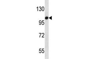 TLR7 antibody western blot analysis in HepG2 lysate (TLR7 Antikörper  (AA 899-926))