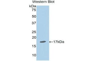 Western Blotting (WB) image for anti-Nuclear Receptor Subfamily 3, Group C, Member 1 (Glucocorticoid Receptor) (NR3C1) (AA 41-184) antibody (ABIN1174819) (Glucocorticoid Receptor Antikörper  (AA 41-184))