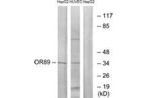 Western blot analysis of extracts from HepG2/HuvEc cells, using OR89 Antibody. (OR89 Antikörper  (AA 220-269))