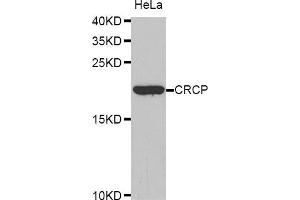 Western Blotting (WB) image for anti-CGRP Receptor Component (CRCP) (AA 1-115) antibody (ABIN6220728) (CRCP Antikörper  (AA 1-115))