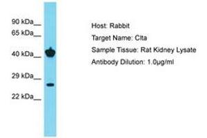 Image no. 1 for anti-Clathrin, Light Chain A/B (CLTA/CLTB) (C-Term) antibody (ABIN6750433) (CLTA/CLTB Antikörper  (C-Term))