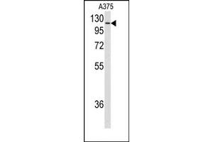 Image no. 1 for anti-Heat Shock 105kDa/110kDa Protein 1 (HSPH1) (C-Term) antibody (ABIN358041) (HSPH1 Antikörper  (C-Term))
