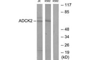 Western blot analysis of extracts from Jurkat/K562 cells, using ADCK2 Antibody.