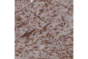 Immunohistochemical staining (Formalin-fixed paraffin-embedded sections) of human substantia nigra pars reticulata with SLC32A1 monoclonal antibody, clone CL2793  shows positivity in GABAergic neural fibers. (SLC32A1 Antikörper)