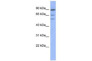 WB Suggested Anti-TRIM50 Antibody Titration:  0. (TRIM50 Antikörper  (Middle Region))
