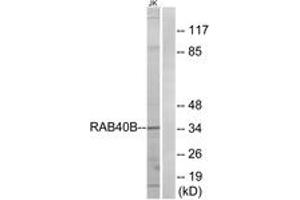 Western blot analysis of extracts from Jurkat cells, using RAB40B Antibody.