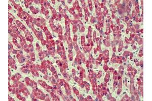 Human Liver: Formalin-Fixed, Paraffin-Embedded (FFPE) (ANTXR2 Antikörper)