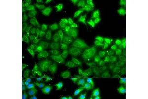Immunofluorescence analysis of A549 cells using NLRC4 Polyclonal Antibody (NLRC4 Antikörper)