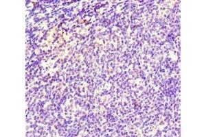 Immunohistochemistry of paraffin-embedded human lymph node tissue using ABIN7171353 at dilution of 1:100 (TCL1A Antikörper  (AA 1-90))