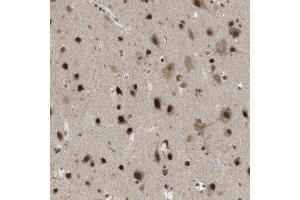 Immunohistochemical staining (Formalin-fixed paraffin-embedded sections) of human cerebral cortex using KAT5 polyclonal antibody  shows strong nuclear positivity in neurons. (KAT5 Antikörper  (AA 150-286))