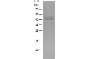 ACTN1 Protein (AA 272-490) (His-IF2DI Tag)