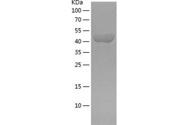 ACTN1 Protein (AA 272-490) (His-IF2DI Tag)