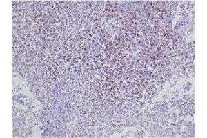Immunohistochemistry (IHC) image for anti-CD8 (CD8) antibody (ABIN1449140) (CD8 Antikörper)
