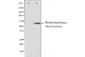 Synaptotagmin Antikörper  (pThr202)