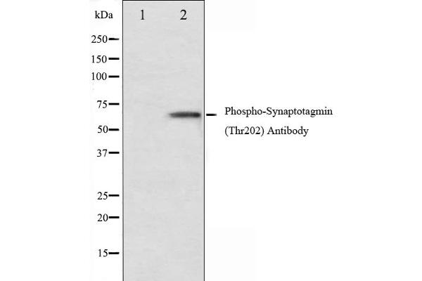 Synaptotagmin Antikörper  (pThr202)