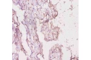 Immunohistochemistry of paraffin-embedded human placenta tissue using ABIN7158439 at dilution of 1:20 (LRBA Antikörper  (AA 2-252))
