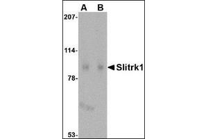 Western blot analysis of Slitrk1 in human brain tissue lysate with this product at (A) 1 and (B) 2 μg/ml. (SLITRK1 Antikörper  (C-Term))
