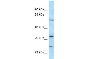 Western Blot showing MAD2L1BP antibody used at a concentration of 1 ug/ml against MDA-MB-435S Cell Lysate (MAD2L1BP Antikörper  (N-Term))