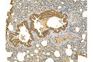 anti-CG4606 Gene Product From Transcript CG4606-RA (ALPHA-MAN-IIB) (N-Term) antibody